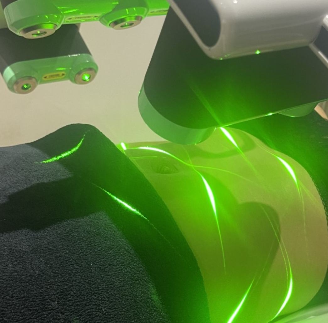 Emerald Laser Treatment