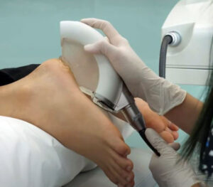 What is PiezoWave Shockwave Therapy?